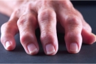 Лечение суставов пальцев