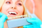 Эстетическая реставрация зубов  (1 по 3 зуб)