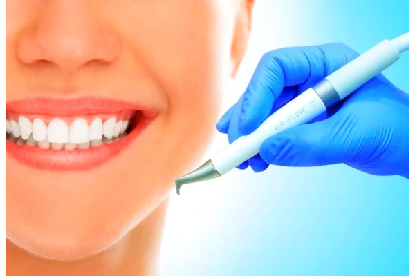 Снятие зубного налета AIR-FLOW(чистка+ покрытие зубов пастой антикариес)