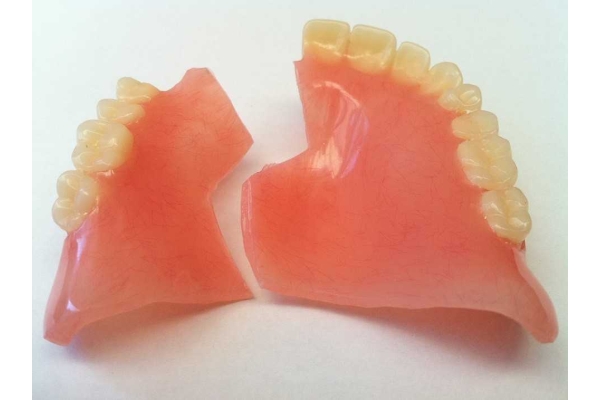 Починка протеза (приварка зуба к протезу) +слепок