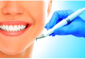 Снятие зубного налета AIR-FLOW(чистка+ покрытие зубов пастой антикариес)
