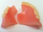 Починка протеза (приварка зуба к протезу) +слепок